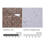 Atlas Antibodies Anti-ALDH7A1 Antibody