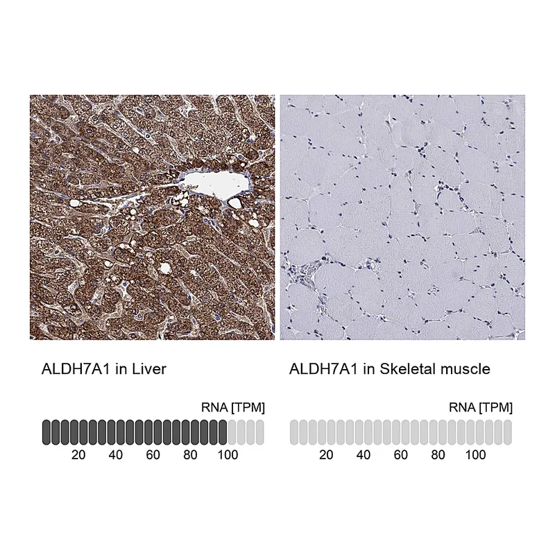 Atlas Antibodies Anti-ALDH7A1 Antibody