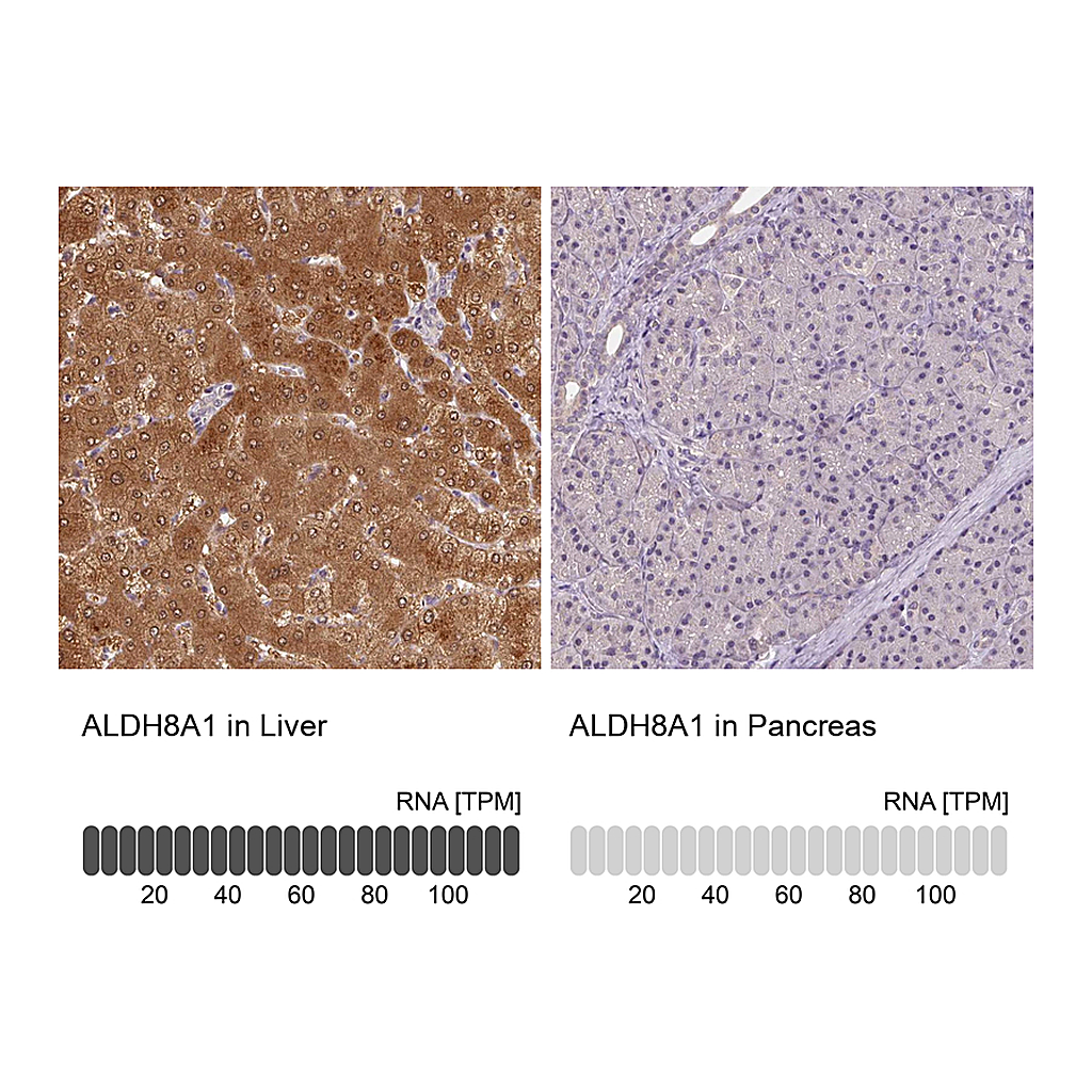 Atlas Antibodies Anti-ALDH8A1 Antibody