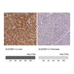 Atlas Antibodies Anti-ALDH8A1 Antibody