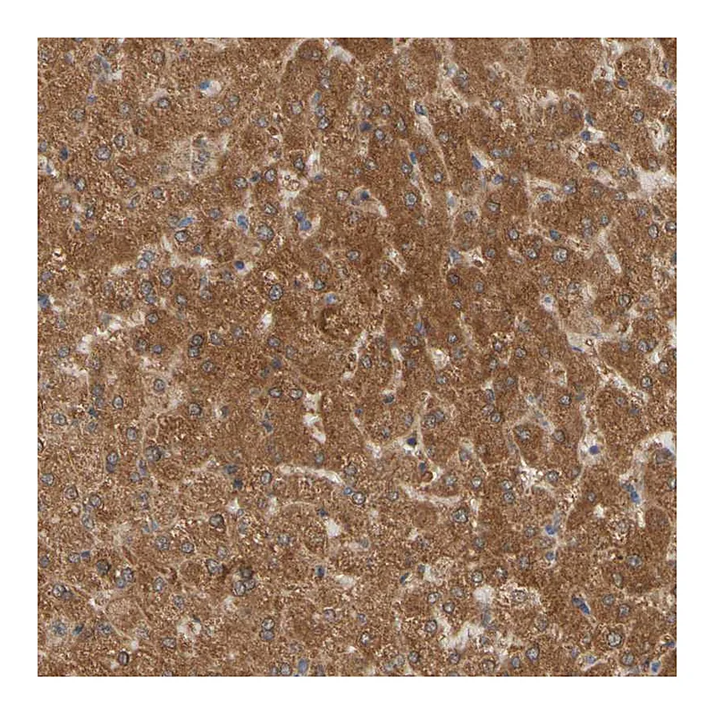 Atlas Antibodies Anti-ALDH9A1 Antibody