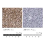 Atlas Antibodies Anti-ALDH8A1 Antibody