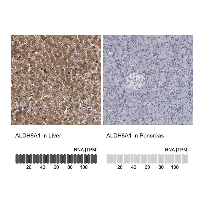 Atlas Antibodies Anti-ALDH8A1 Antibody