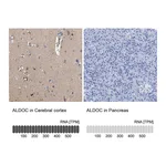 Atlas Antibodies Anti-ALDOC Antibody