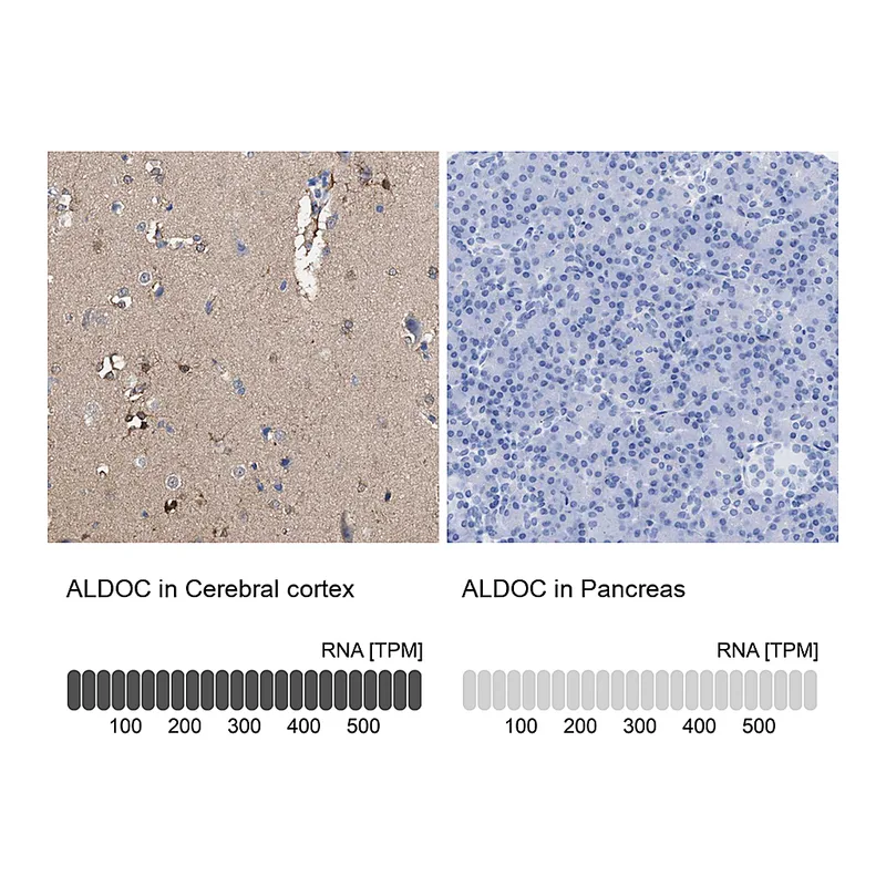 Atlas Antibodies Anti-ALDOC Antibody