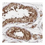 Atlas Antibodies Anti-ALG1 Antibody