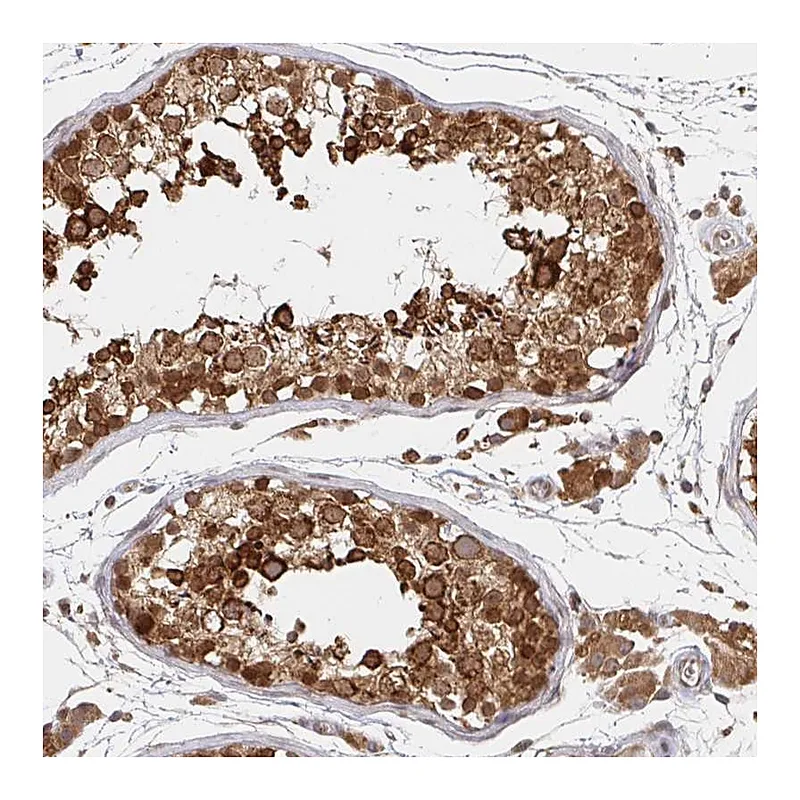 Atlas Antibodies Anti-ALG1 Antibody