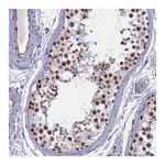 Atlas Antibodies Anti-ALG10 Antibody
