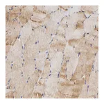 Atlas Antibodies Anti-ALDOA Antibody