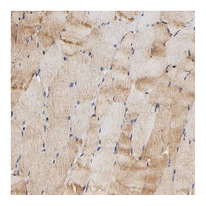 Atlas Antibodies Anti-ALDOA Antibody