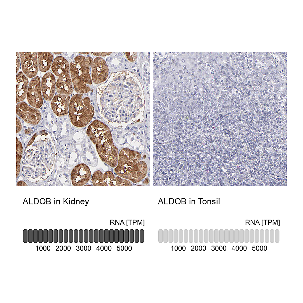 Atlas Antibodies Anti-ALDOB Antibody