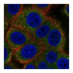 Atlas Antibodies Anti-ALG12 Antibody