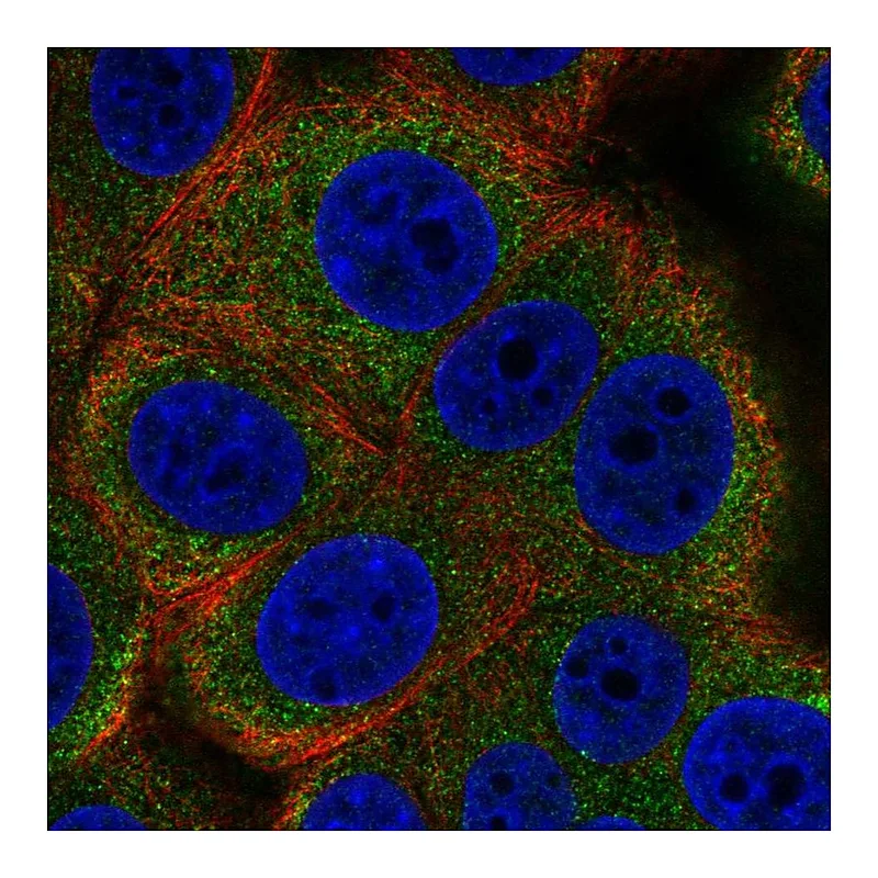 Atlas Antibodies Anti-ALG12 Antibody