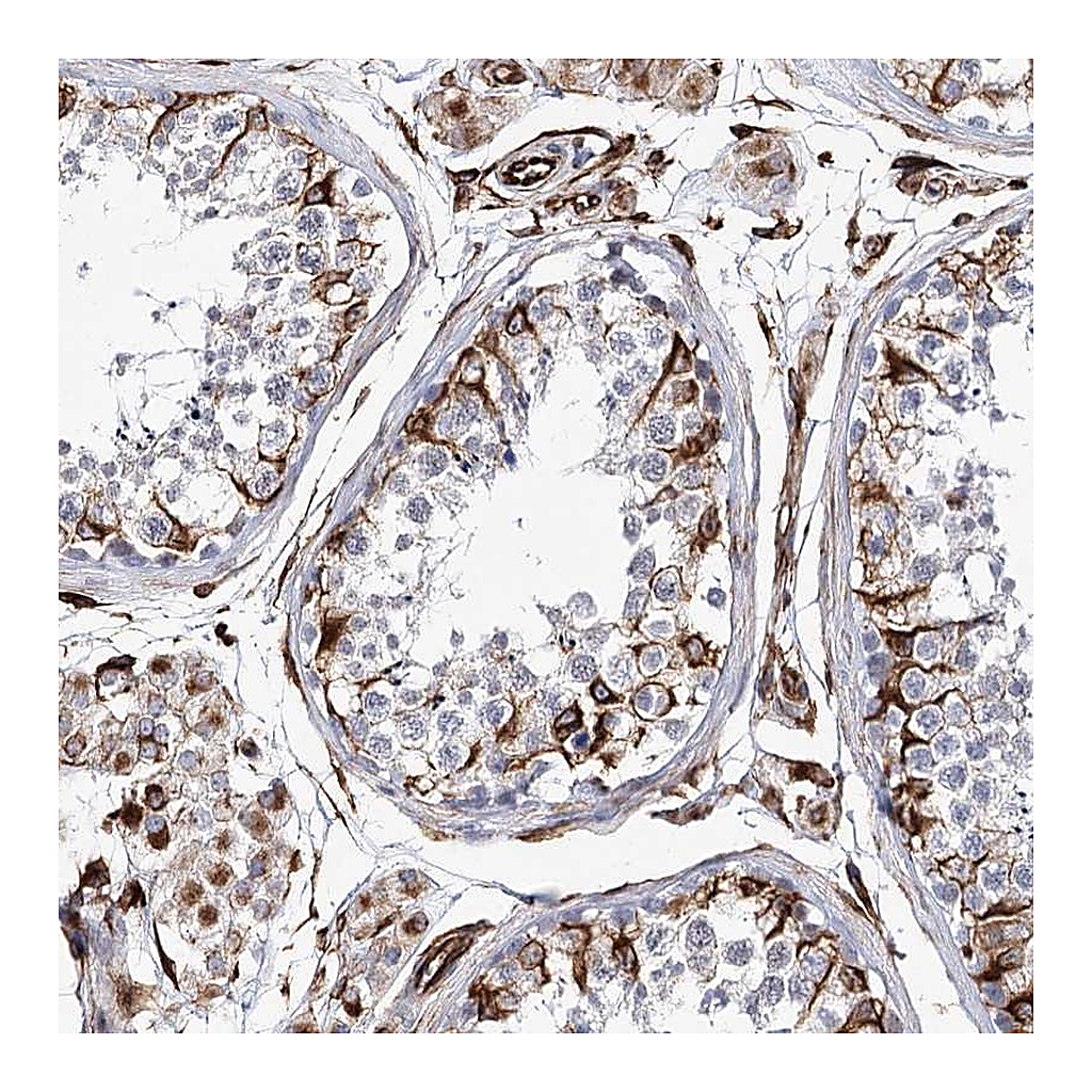 Atlas Antibodies Anti-ALG1L Antibody