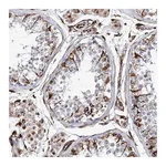 Atlas Antibodies Anti-ALG1L Antibody