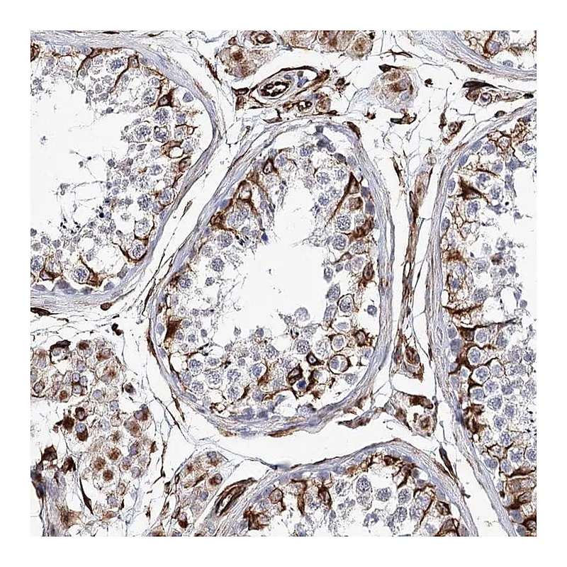 Atlas Antibodies Anti-ALG1L Antibody