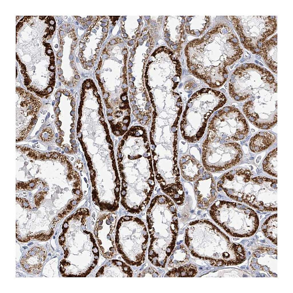Atlas Antibodies Anti-ALG12 Antibody