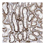 Atlas Antibodies Anti-ALG12 Antibody