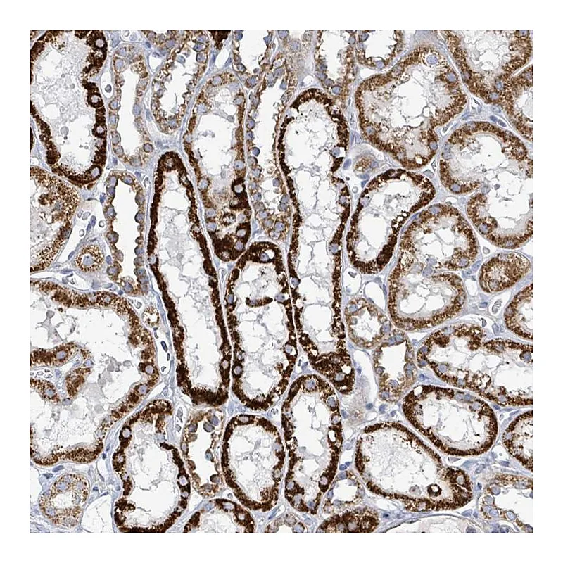 Atlas Antibodies Anti-ALG12 Antibody