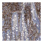 Atlas Antibodies Anti-ALG14 Antibody