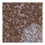 Atlas Antibodies Anti-ALG2 Antibody
