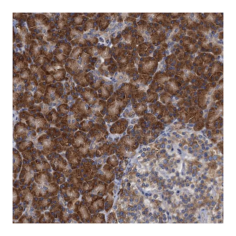 Atlas Antibodies Anti-ALG2 Antibody