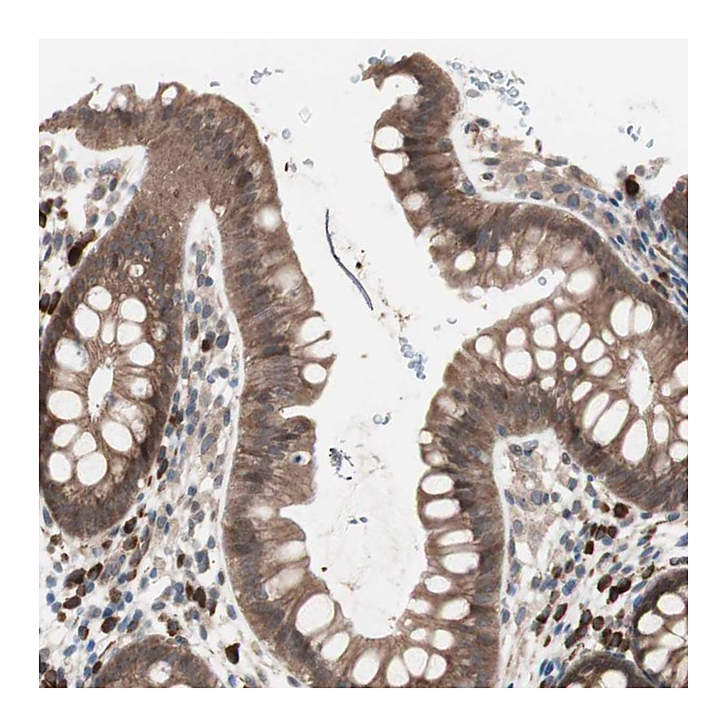 Atlas Antibodies Anti-ALG5 Antibody