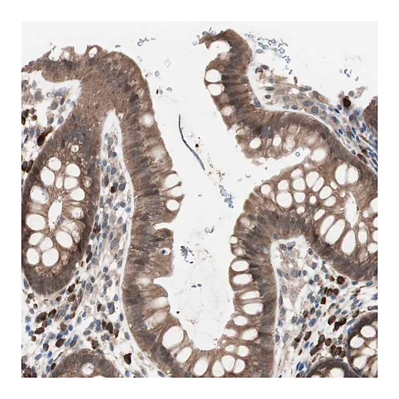 Atlas Antibodies Anti-ALG5 Antibody