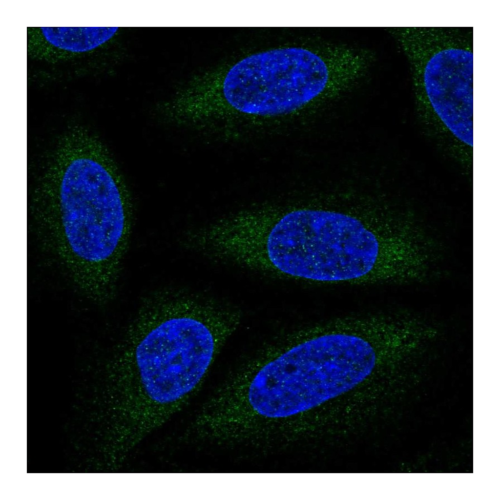Atlas Antibodies Anti-ALG6 Antibody