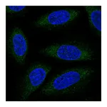 Atlas Antibodies Anti-ALG6 Antibody