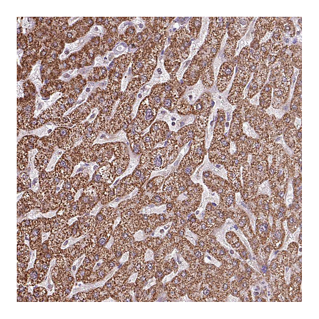 Atlas Antibodies Anti-ALG8 Antibody
