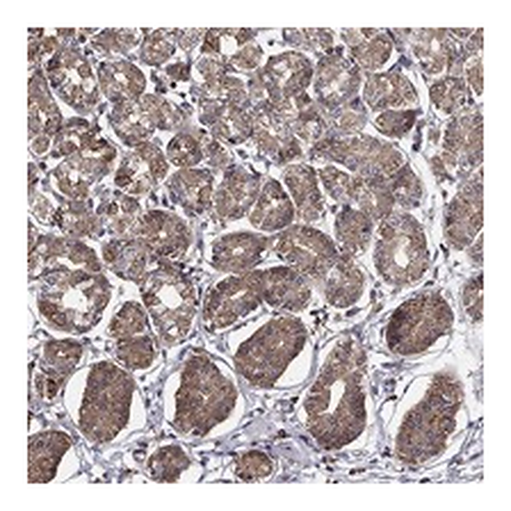 Atlas Antibodies Anti-ALG6 Antibody
