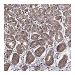 Atlas Antibodies Anti-ALG6 Antibody