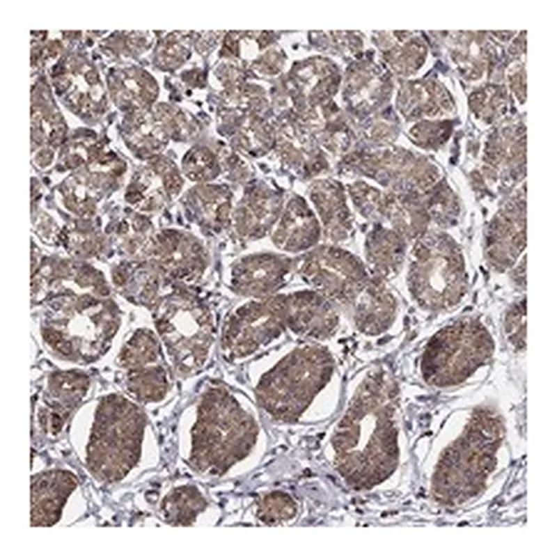 Atlas Antibodies Anti-ALG6 Antibody