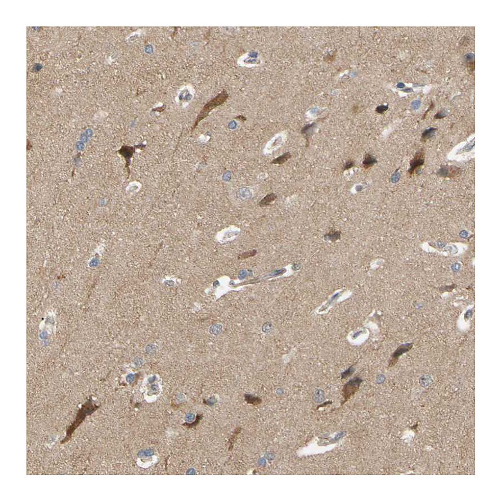 Atlas Antibodies Anti-ALK Antibody