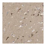 Atlas Antibodies Anti-ALK Antibody