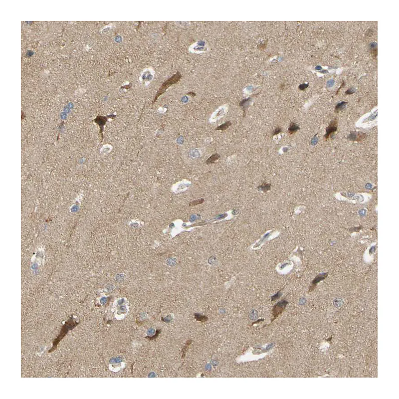 Atlas Antibodies Anti-ALK Antibody