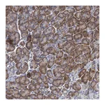 Atlas Antibodies Anti-ALG2 Antibody