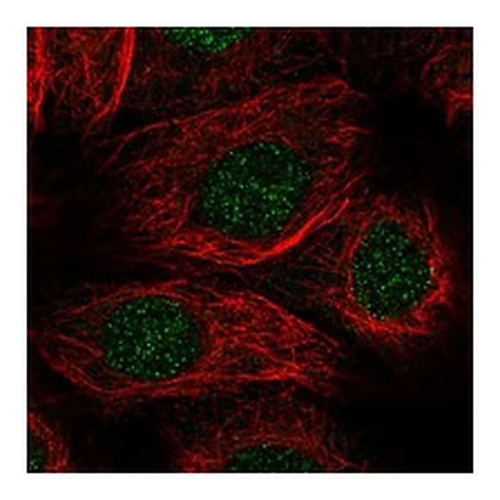 Atlas Antibodies Anti-ALKBH1 Antibody