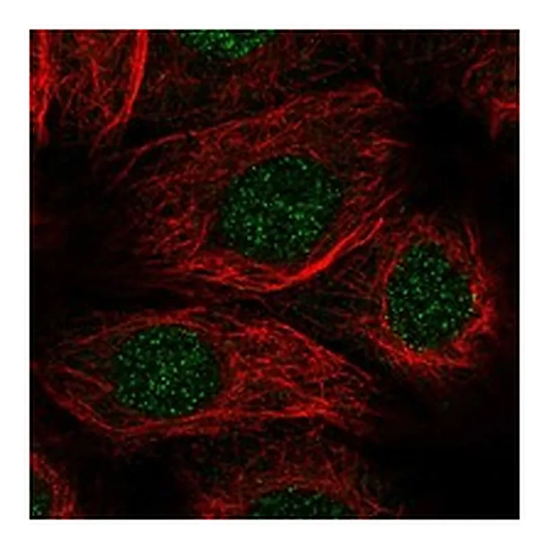 Atlas Antibodies Anti-ALKBH1 Antibody