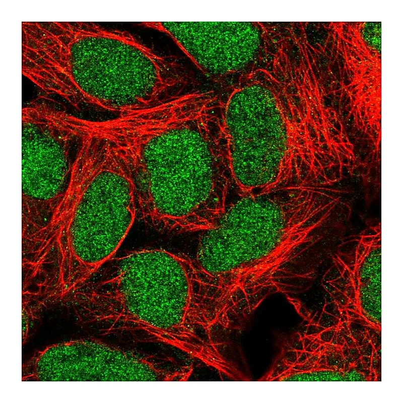 Atlas Antibodies Anti-ALKBH2 Antibody
