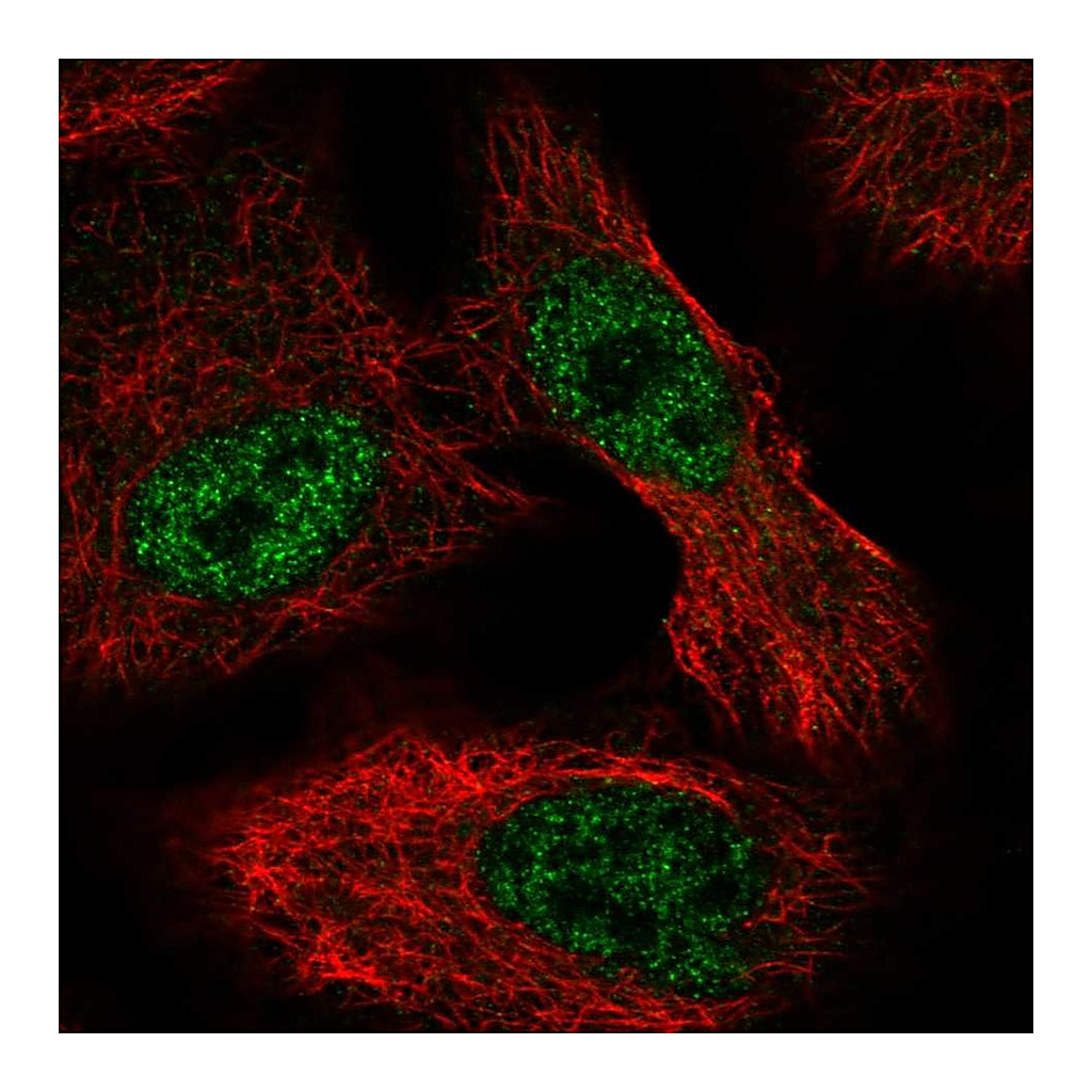 Atlas Antibodies Anti-ALKBH6 Antibody