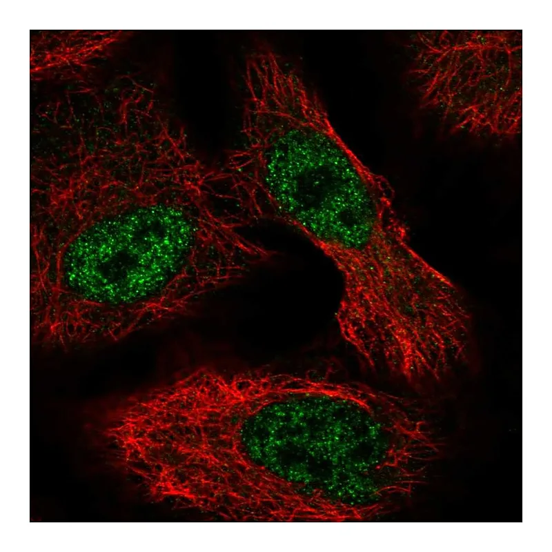 Atlas Antibodies Anti-ALKBH6 Antibody