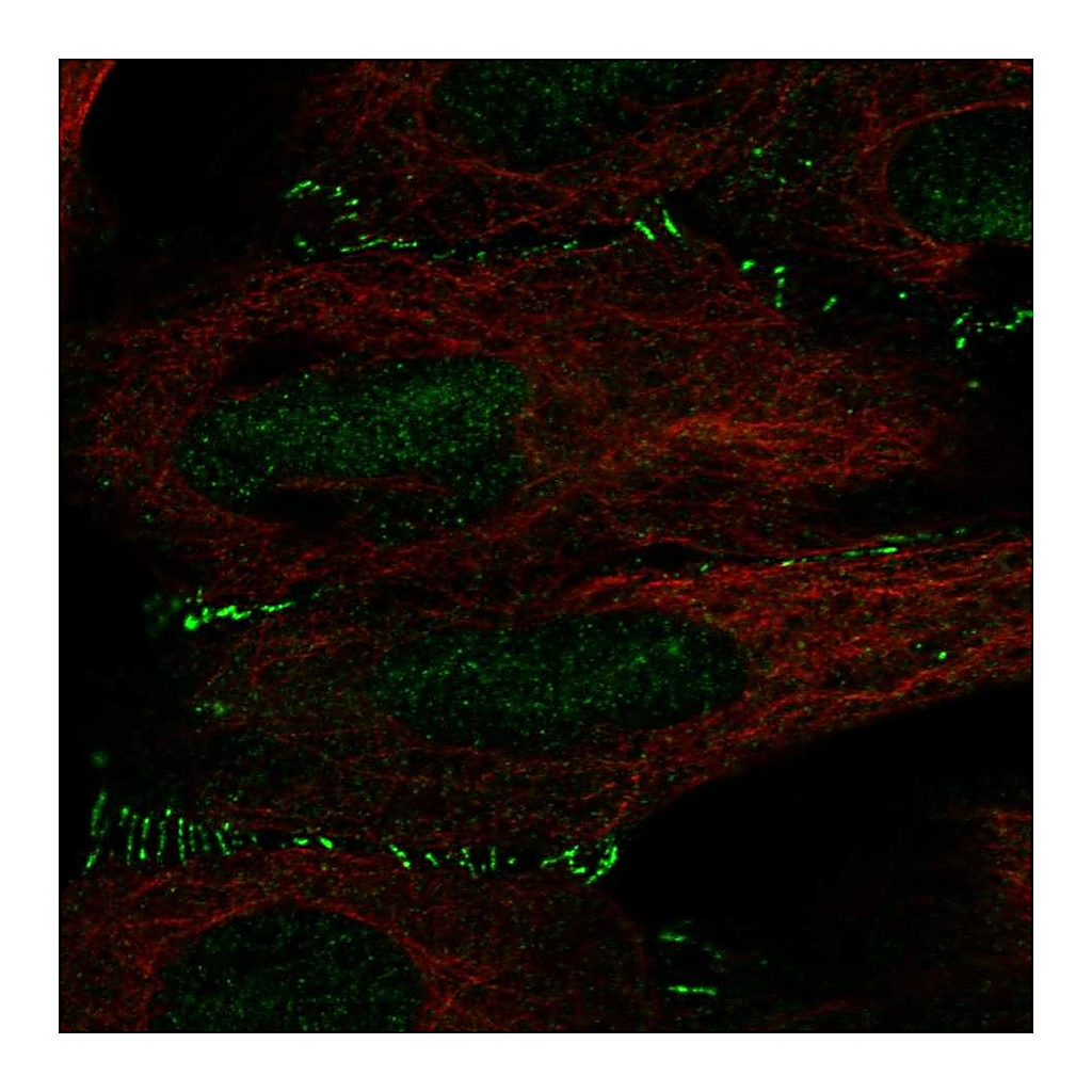 Atlas Antibodies Anti-ALKBH6 Antibody