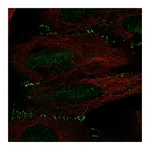 Atlas Antibodies Anti-ALKBH6 Antibody