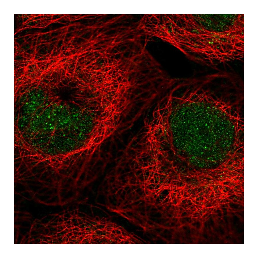 Atlas Antibodies Anti-ALKBH3 Antibody