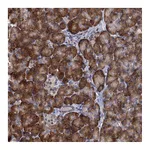 Atlas Antibodies Anti-ALKBH7 Antibody