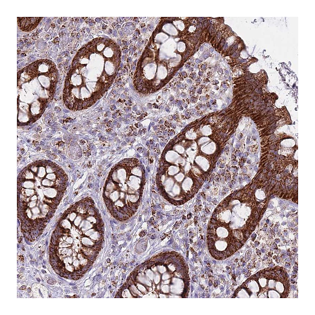 Atlas Antibodies Anti-ALKBH4 Antibody