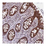 Atlas Antibodies Anti-ALKBH4 Antibody