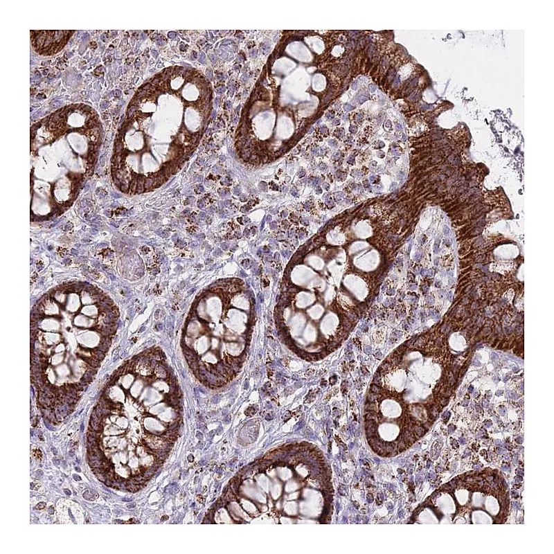 Atlas Antibodies Anti-ALKBH4 Antibody